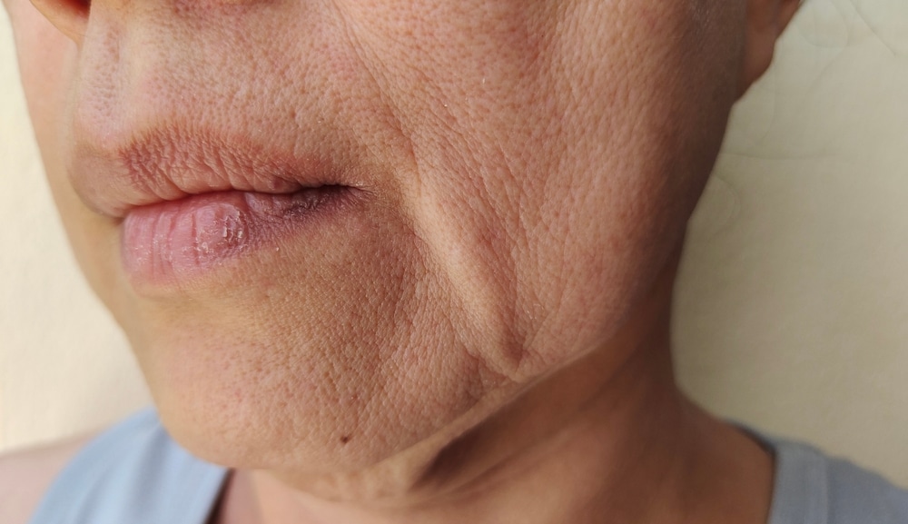 Portrait,Showing,The,Wrinkles,Skin,,Flabby,Sagging,And,Dry,Skin
