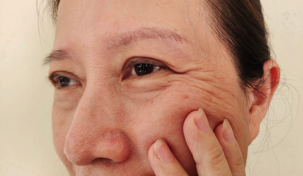 Portrait,Showing,The,Flabbiness,Adipose,Sagging,Skin,,Wrinkles,And,Flabby
